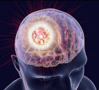 brain image